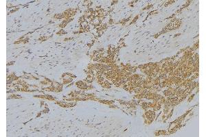ABIN6272872 at 1/100 staining Human lung tissue by IHC-P. (Sulfiredoxin 1 抗体  (Internal Region))