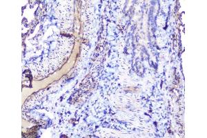 IHC analysis of INPPL1 using anti-INPPL1 antibody (ABIN6719492). (INPPL1 抗体  (AA 1172-1258))