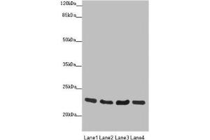 Western blot All lanes: RAB18 antibody at 0. (RAB18 抗体  (AA 1-206))