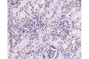 ABIN6267312 at 1/200 staining human kidney tissue sections by IHC-P. (LCK 抗体  (pTyr505))