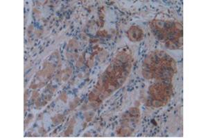IHC-P analysis of Human Stomach Tissue, with DAB staining. (IL1A 抗体  (AA 113-271))