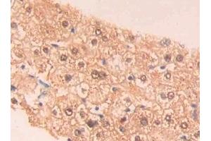 Detection of PAH in Human Liver Tissue using Polyclonal Antibody to Phenylalanine Hydroxylase (PAH) (Phenylalanine Hydroxylase 抗体  (AA 1-226))