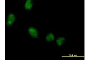 Immunofluorescence of purified MaxPab antibody to LMCD1 on HeLa cell. (LMCD1 抗体  (AA 1-365))