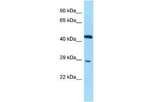 Host: Rabbit Target Name: DNAJC8 Sample Type: Jurkat Whole Cell lysates Antibody Dilution: 1. (DNAJC8 抗体  (C-Term))