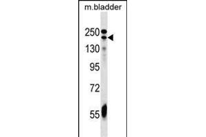 ADCY9 Antibody (C-term) (ABIN1536696 and ABIN2849404) western blot analysis in mouse bladder tissue lysates (35 μg/lane). (ADCY9 抗体  (C-Term))