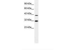 Image no. 1 for anti-Interferon Regulatory Factor 2 (IRF2) (AA 52-101) antibody (ABIN6735872) (IRF2 抗体  (AA 52-101))