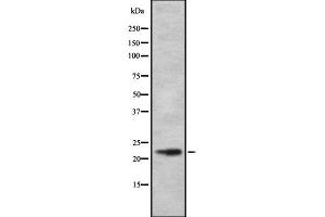 Western blot analysis of DRD1IP using RAW264. (CALY 抗体  (Internal Region))