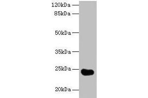 Western blot All lanes: GGTLC2 antibody at 2 μg/mL + Mouse kidney tissue Secondary Goat polyclonal to rabbit IgG at 1/10000 dilution Predicted band size: 24 kDa Observed band size: 24 kDa (GGTLC2 抗体  (AA 1-218))