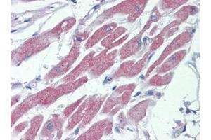 Human Heart: Formalin-Fixed, Paraffin-Embedded (FFPE) (STK39 抗体  (C-Term))