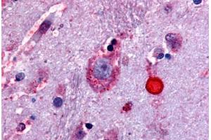 Anti-Delta Opioid Receptor antibody  ABIN1048496 IHC staining of human brain. (OPRD1 抗体  (Extracellular Domain))