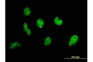 Immunofluorescence of purified MaxPab antibody to EP400 on HeLa cell. (EP400 抗体  (AA 1-985))