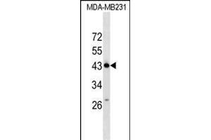 ZN Antibody (N-term) (ABIN1539540 and ABIN2849490) western blot analysis in MDA-M cell line lysates (35 μg/lane). (ZNF550 抗体  (N-Term))