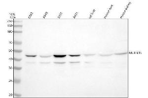 anti-Methyltransferase 5 Domain Containing 1 (METT5D1) (AA 200-407) antibody