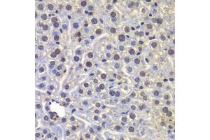 Immunohistochemistry of paraffin-embedded mouse liver using FUBP3 antibody. (FUBP3 抗体  (AA 65-260))