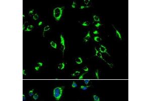 Immunofluorescence analysis of MCF-7 cells using APOBEC3G Polyclonal Antibody