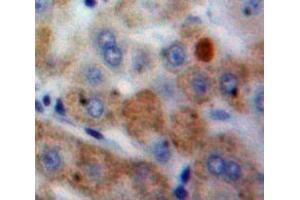Used in DAB staining on fromalin fixed paraffin-embedded Liver tissue (CSTA 抗体  (AA 1-98))