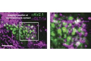 Image of cultured hippocampal cells immune-labeled with antibodies specific for Kv2.