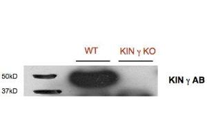 Western Blotting (WB) image for anti-SNF1-Related Protein Kinase Regulatory Subunit gamma 1 (KING1) (Regulatory Subunit Gamma) antibody (ABIN5326729) (KING1 抗体  (Regulatory Subunit Gamma))