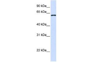 WDR40A antibody used at 1 ug/ml to detect target protein. (DCAF12 抗体  (Middle Region))