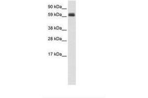 Image no. 1 for anti-T-Bet (AA 36-85) antibody (ABIN202727) (T-Bet 抗体  (AA 36-85))