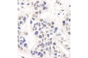 Immunohistochemistry (IHC) image for anti-DNA Cross-Link Repair 1C (DCLRE1C) (C-Term) antibody (ABIN7454515) (DCLRE1C 抗体  (C-Term))