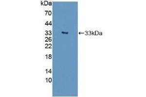 Detection of Recombinant SST, Human using Polyclonal Antibody to Autophagy Related Protein 16 Like Protein 1 (ATG16L1) (ATG16L1 抗体  (AA 342-607))