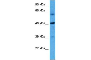 Host:  Rat  Target Name:  HSD11B2  Sample Tissue:  Rat Liver  Antibody Dilution:  1ug/ml (HSD11B2 抗体  (N-Term))