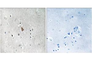 Immunohistochemistry analysis of paraffin-embedded human brain tissue, using Insulin Like Growth Factor 1 Receptor (IGF1R) (Phospho-Tyr1346) antibody. (IGF1R 抗体  (pTyr1346))