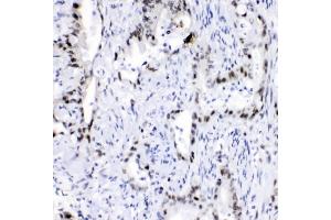 IHC analysis of hnRNP A2B1 using anti-hnRNP A2B1 antibody (ABIN5692872). (HNRNPA2B1 抗体)