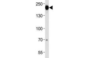 Epidermal Growth Factor Receptor antibody western blot analysis in A431 lysate (EGFR 抗体  (AA 1070-1099))