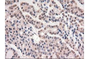 Image no. 15 for anti-Myc Proto-Oncogene protein (MYC) antibody (ABIN1497011) (c-MYC 抗体)