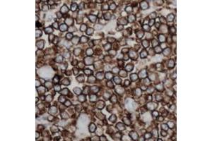 Immunohistochemistry (IHC) image for anti-Tumor Necrosis Factor (Ligand) Superfamily, Member 11 (TNFSF11) (Center) antibody (ABIN7301382)