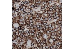 Immunohistochemical analysis of CD254 staining in human lymph node formalin fixed paraffin embedded tissue section. (RANKL 抗体  (Center))