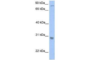 Western Blotting (WB) image for anti-Glutathione S-Transferase theta 1 (GSTT1) antibody (ABIN2459202) (GSTT1 抗体)