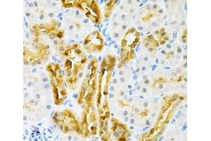 Immunohistochemistry of paraffin-embedded Rat kidney using SULT2A1 Polyclonal Antibody at dilution of 1:200 (40x lens). (SULT2A1 抗体)
