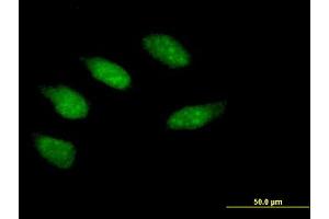 Immunofluorescence of purified MaxPab antibody to EGR2 on HeLa cell. (EGR2 抗体  (AA 1-476))