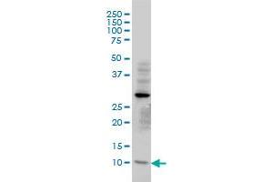 TIMM8A monoclonal antibody (M01), clone 2F11 Western Blot analysis of TIMM8A expression in HeLa .