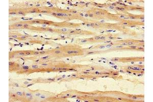 Immunohistochemistry of paraffin-embedded human heart tissue using ABIN7171028 at dilution of 1:100 (SMNDC1 抗体  (AA 1-238))