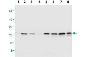 Western blot analysis of tissue and whole cell extracts with SOCS2 polyclonal antibody . (SOCS2 抗体  (C-Term))