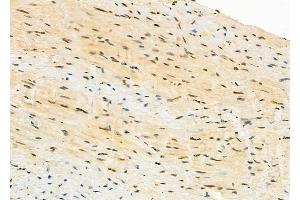 ABIN6263011 and ABIN6273265 at 1/100 staining Mouse heart tissue by IHC-P.