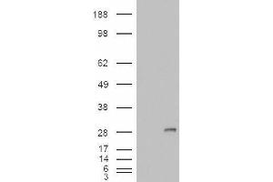 HEK293 overexpressing IGFBP6 and probed with ABIN2563362 (mock transfection in first lane). (IGFBP6 抗体  (Internal Region))
