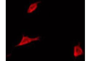 ABIN6272350 staining COLO205 by IF/ICC. (MYL12B 抗体)