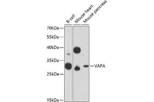 Western blot analysis of extracts of various cell lines, using VAPA Antibody (ABIN6132892, ABIN6150056, ABIN6150057 and ABIN6216758) at 1:3000 dilution. (VAPA 抗体  (AA 137-227))