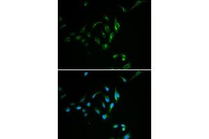 Immunofluorescence analysis of MCF7 cell using CPT2 antibody. (CPT2 抗体)