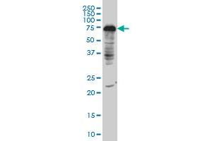 DCP1A monoclonal antibody (M06), clone 3G4 Western Blot analysis of DCP1A expression in IMR-32 (DCP1A 抗体  (AA 186-285))