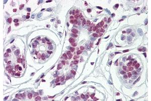 IHC Suggested Anti-HDAC2 antibody  Titration: 5ug/ ml Positive Control: Breast (HDAC2 抗体  (Middle Region))