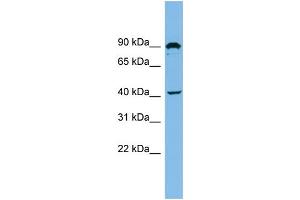 WB Suggested Anti-ZMYND12 Antibody Titration: 0. (ZMYND12 抗体  (N-Term))