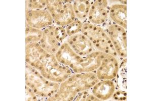 Immunohistochemistry of paraffin-embedded mouse kidney using ANP32A Antibody. (PHAP1 抗体  (AA 1-170))