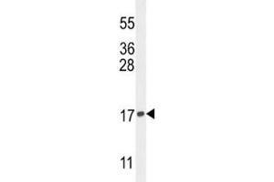 Western blot analysis of Histone H3. (Histone H3.3 抗体  (Lys9))