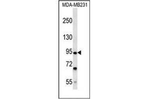 Western blot analysis of FSD2 Antibody (N-term) in MDA-MB231 cell line lysates (35ug/lane). (FSD2 抗体  (N-Term))